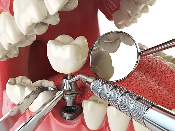 Best Same-Day Emergency Dentist in Rockwood, TN
